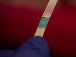 Papel bioativo avalia qualidade da gua das praias